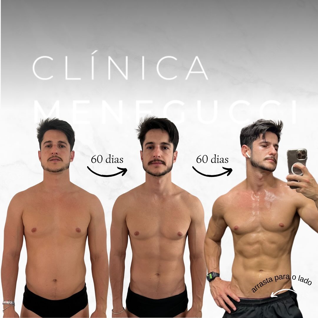 Resultado de emagrecimento de paciente