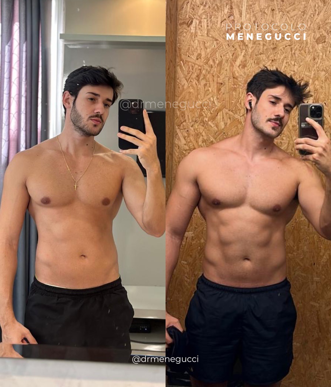 Resultado de hipertrofia de paciente